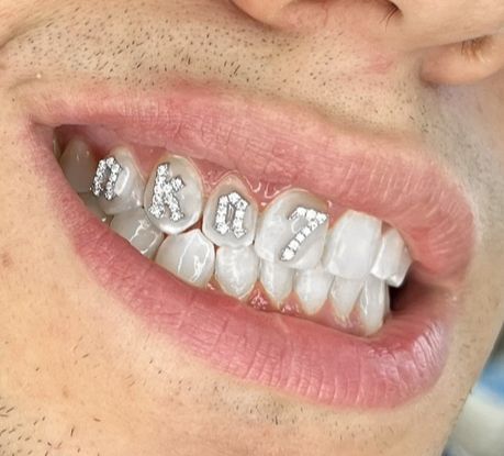 Tooth gem personalizzato AKA 7 brillantini