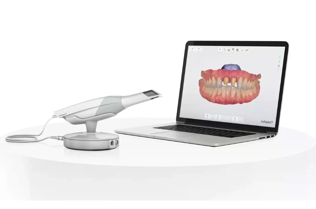 Digital Check-Up - Top Dental Torino