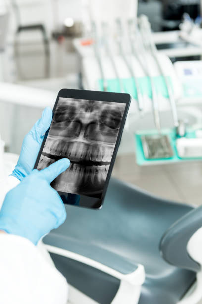 Implantologia a carico immediato