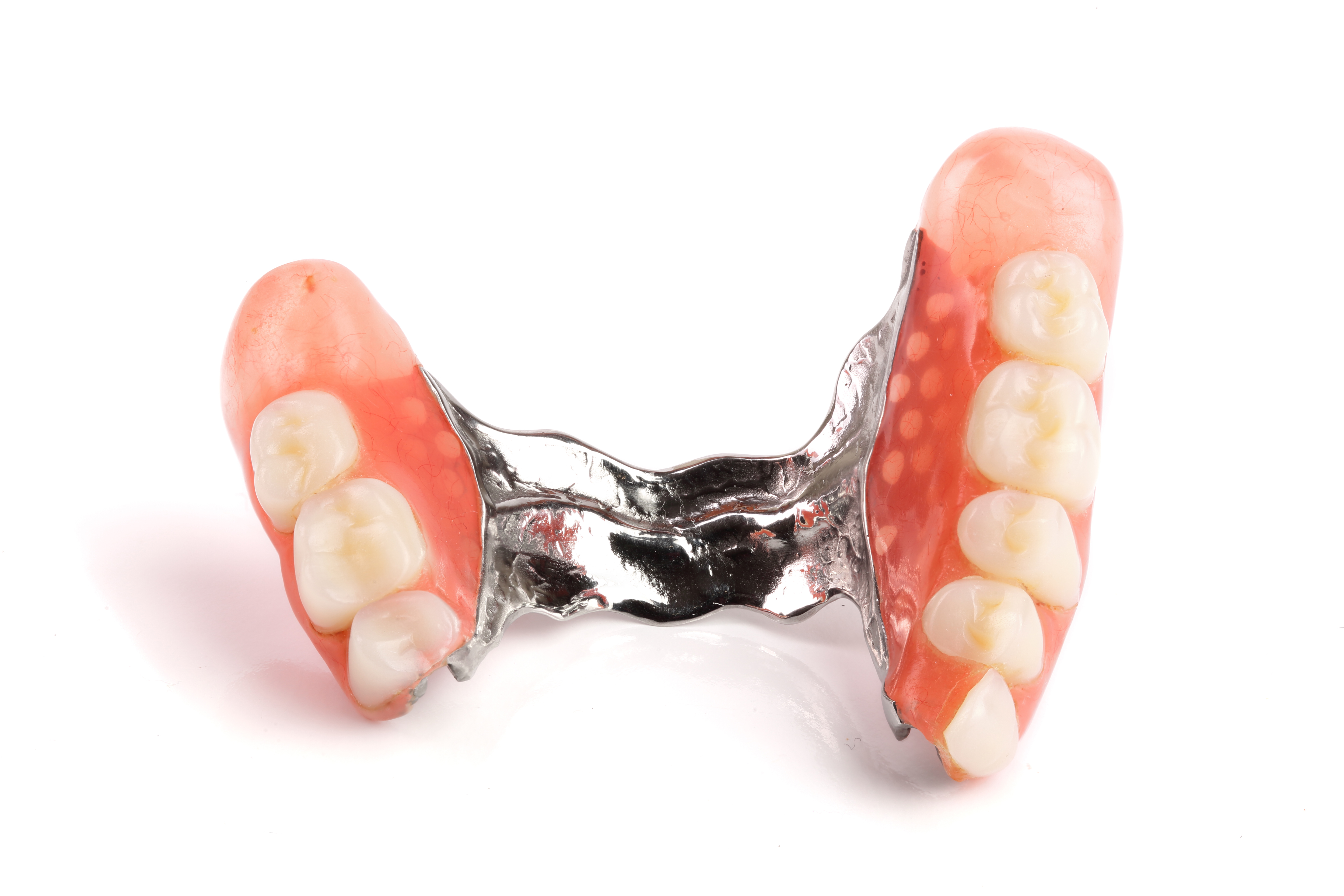Tipologie di protesi fisse - Top Dental Torino